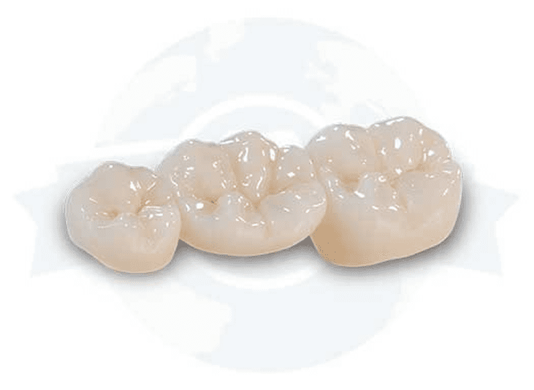 Three ceramic dental crowns close-up
