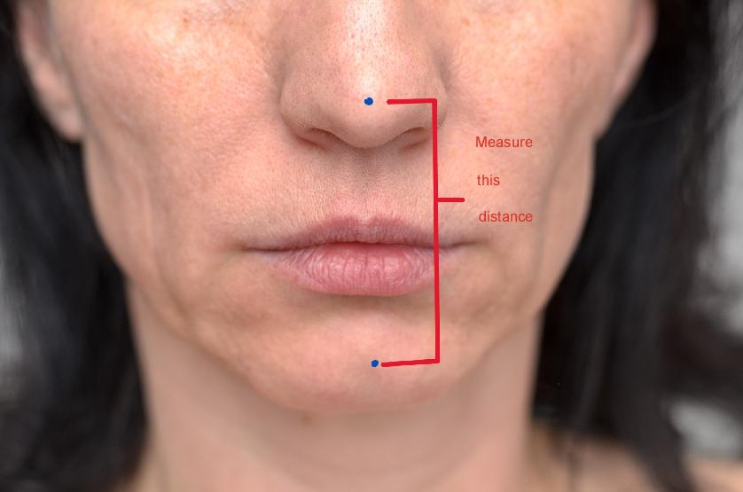 Close-up face showing distance between nose and chin
