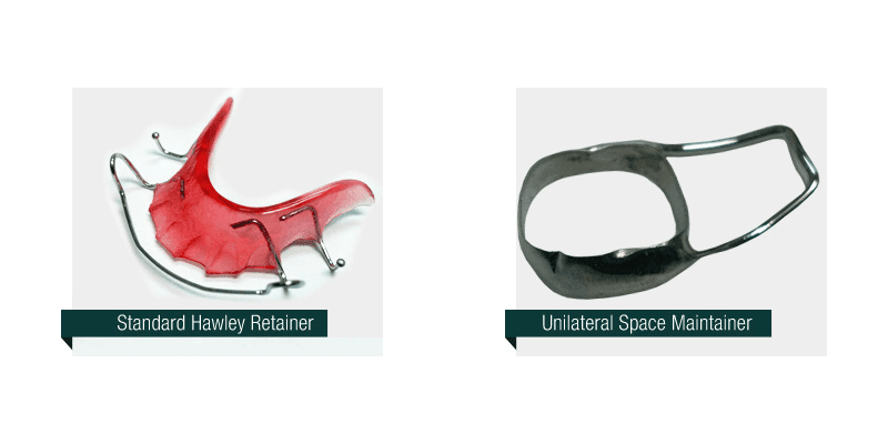 Hawley retainer and unilateral space maintainer