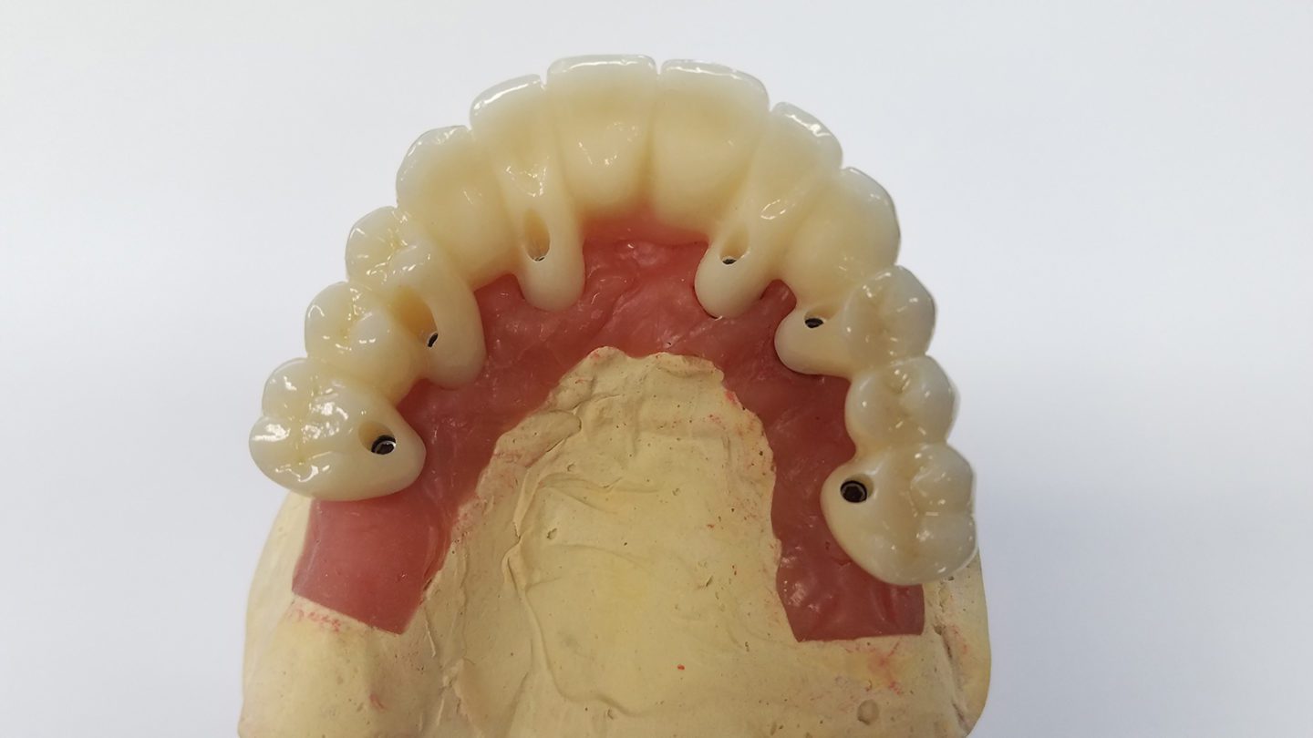 Upper dental prosthetic model with gum base