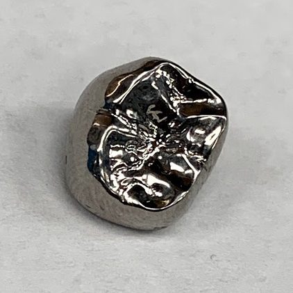 Shiny metal molar dental crown