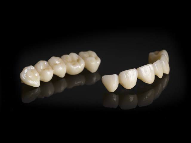 Porcelain dental bridges on black reflective surface