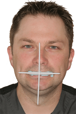 stick bite